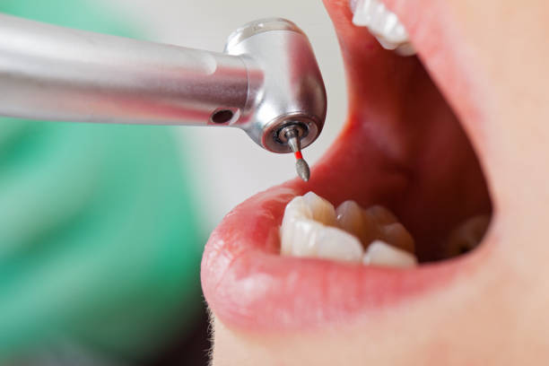 Best Weekend Emergency Dentist in Swanton, OH